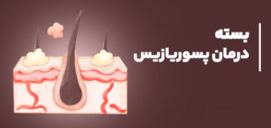 بسته درمان پسوریازیس