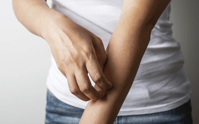 علائم کبد چرب روی پوست