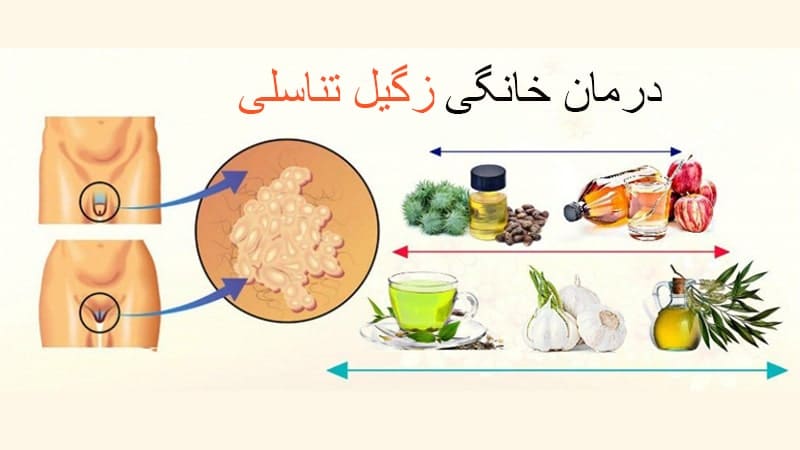 درمان خانگی زگیل تناسلی